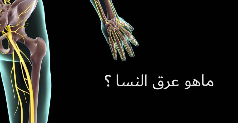 علاج عرق النسا وكل ما يتعلق به صحتي هنا