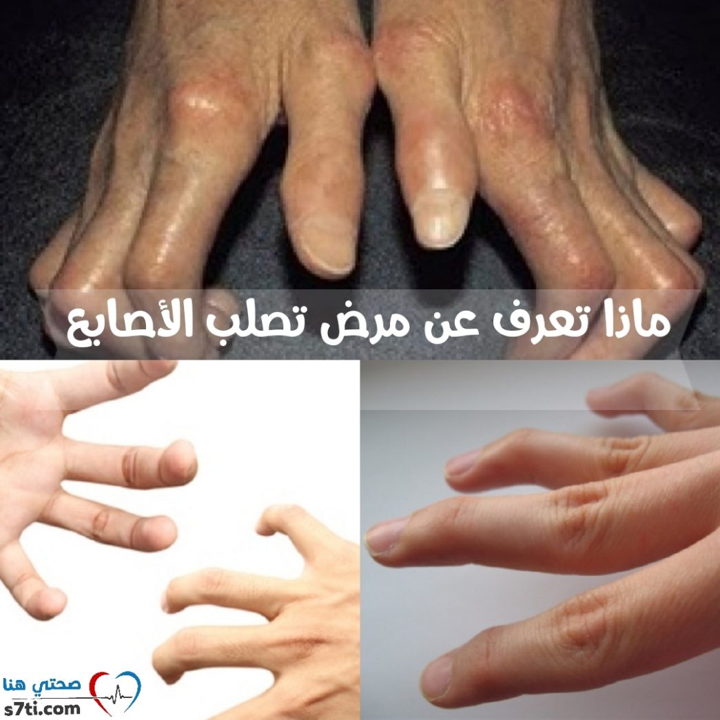 ( ماذا تعرف عن الغدة الدرقية )