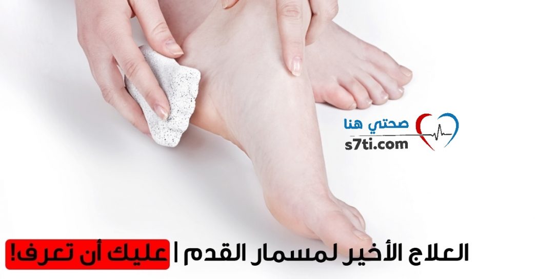مسمار القدم كل ما عليك معرفته عن أسبابه وطرق العلاج صحتي هنا