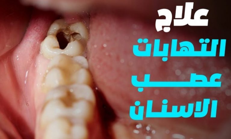 اقوى مسكن للاسنان