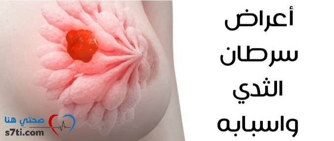 كل شيء عن سرطان الثدي صحتي هنا