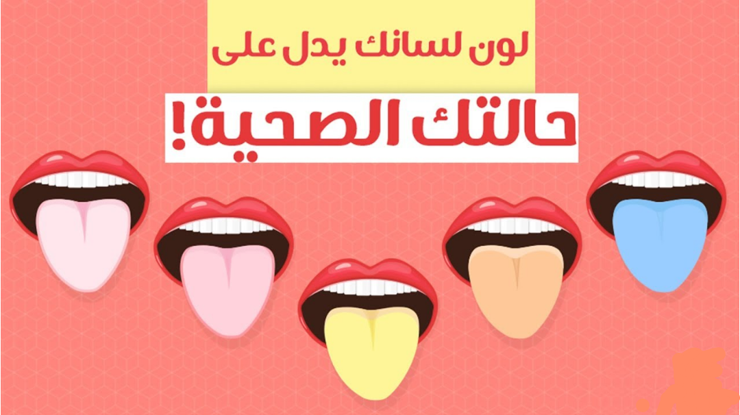 دلالات تغير لون اللسان صحتي هنا