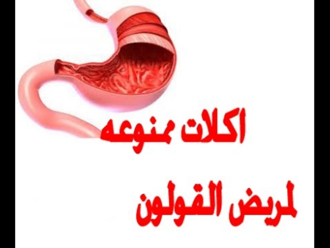 أكلات ممنوعة لمرضى القولون وأخرى مسموح بها صحتي هنا